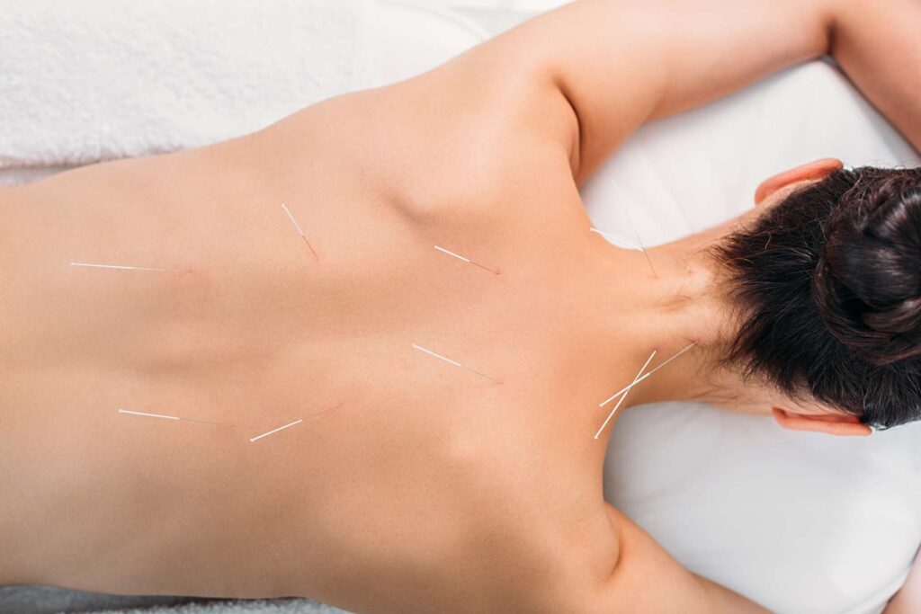 12 Popular Energy Healing Types and How Anyone can Benefit (2024) solheals accupuncture